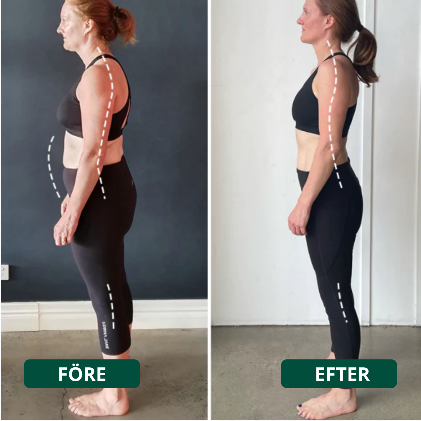 SpineEase™ | Lindra ryggont & stå rak med stolthet