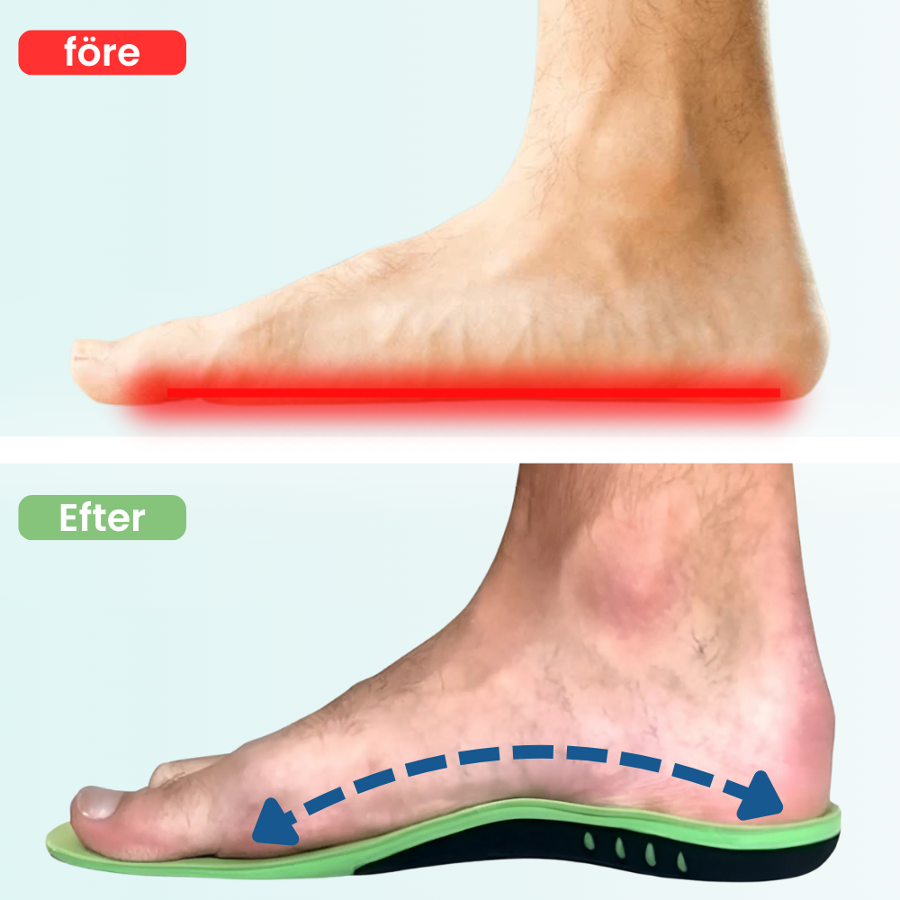 OrthoStep™ | Stöd som lindrar varje steg
