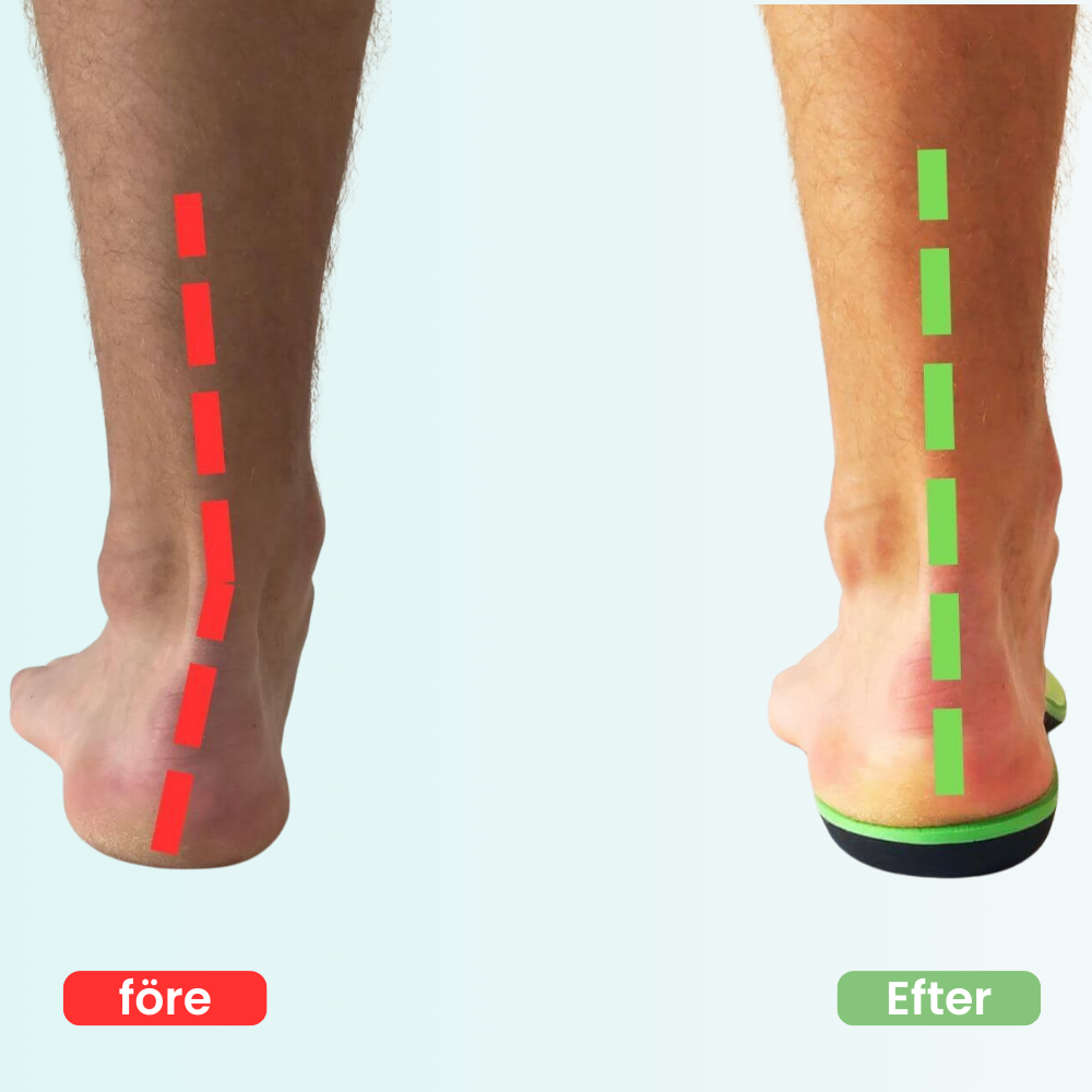 OrthoStep™ | Stöd som lindrar varje steg
