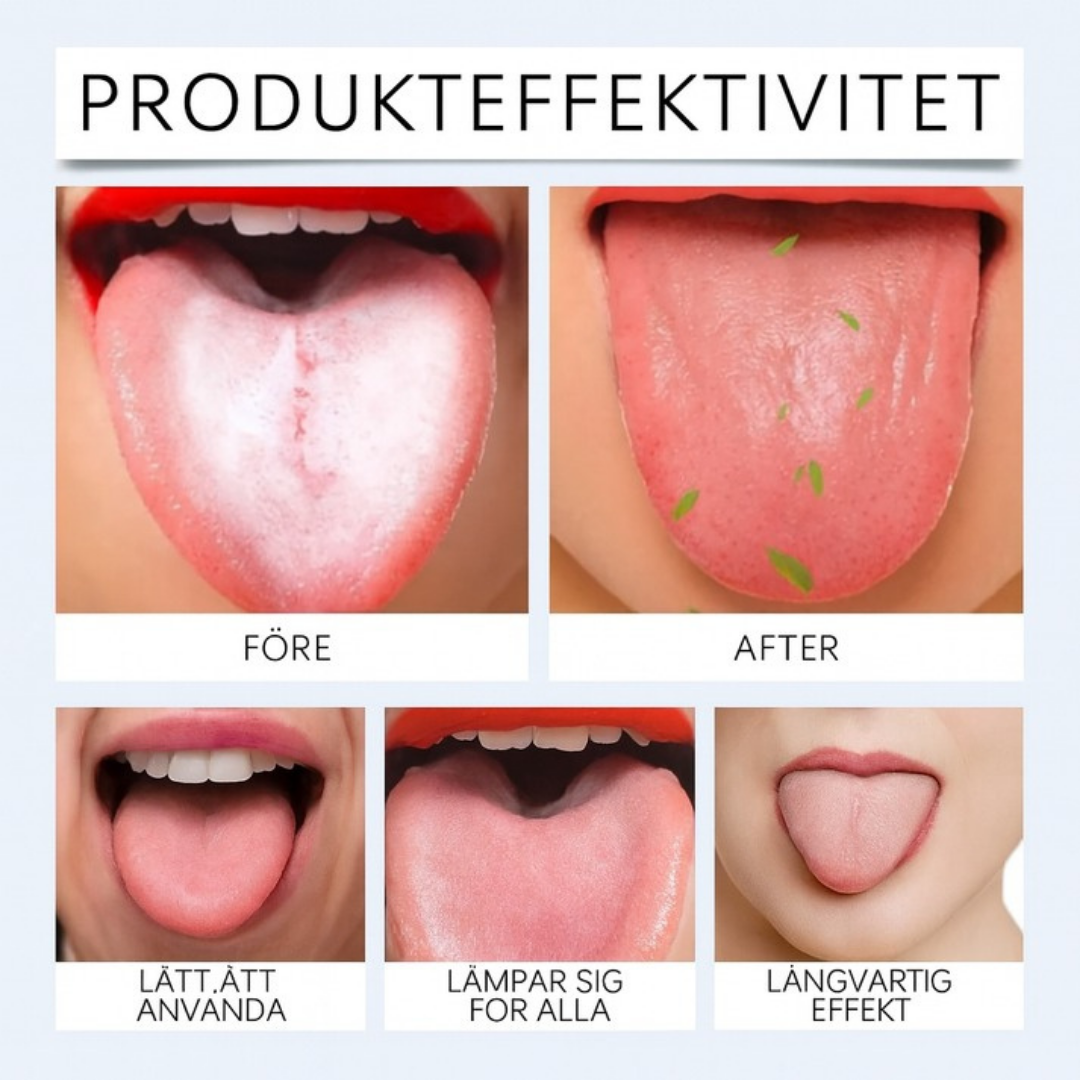 MouthCare™ | Säg adjö till beläggningar på tungan, dålig lukt och bakterier