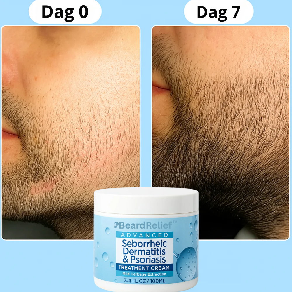 BeardCare™ | Skäggreparationskräm 1+1 GRATIS eller 2+2 GRATIS med extra rabatt!
