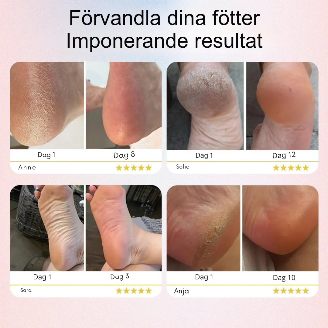 SilkySoft 2.0 | Lösningen för mjuka fötter som baby