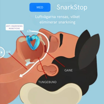 SnarkStop™ |Fri luftväg och tystare nätter